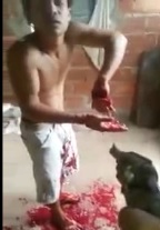 Kids Hand Almost Chopped Off For Stealing