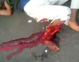 Guy fucked up and his friend dead after accident