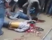 Two kids with head crushed being removed from scene