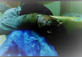 Dudes Nasty Ass Hand Filled with Maggots