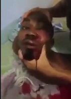 Man Tortured by Cartel For Stealing Money and Posting it on FB