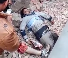 Taking a Pic of the Dude that Died Right Next to his Leg