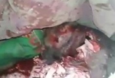 Poor Little Girls Head Leaking Brains