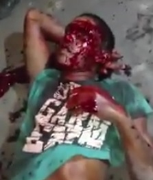 Dude Bloody after Beating Talking to Cops in Total Agony