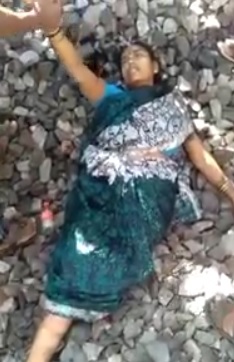 Woman in Shock Lost her Leg in Train Accident