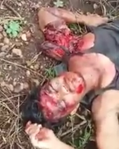 Man in Agony Still Talking with Arm and Leg Ripped apart From Hit and Run