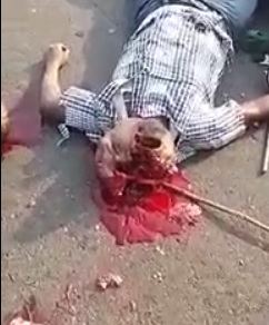 Mans Head Crushed is a Sight to See 