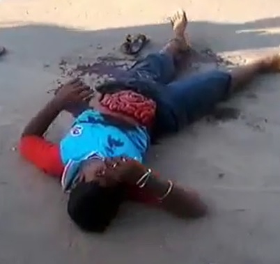 Dude Stabbed and has his Intestines Falling out on the Street