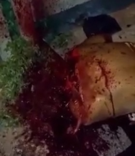 Man Literally Sawed in Half at the Shoulders