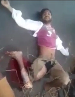 Dude calmly waits for help with his leg almost ripped off