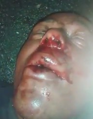 Alleged Rapist was Beaten and Stripped Naked