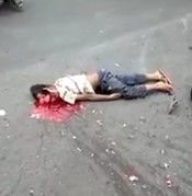 Poor Boys Head Crushed and his Brains Scattered Yards from his Head