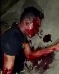 Thug Keeps Calling God's Name While Dying After Gun Shots