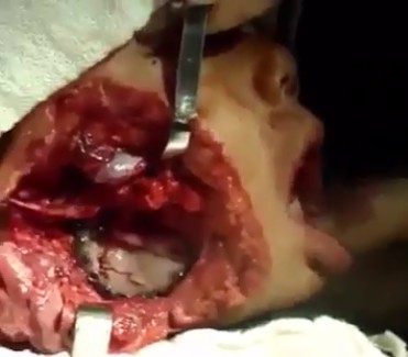 Poor Kid has a Massive Hole in His Face