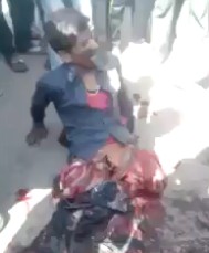 Desperate Man Keeps Trying to move the Rest of his Destroyed Legs