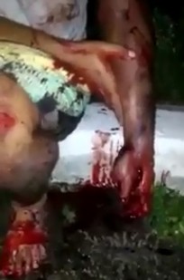 Thief with hand mutilated waits for help