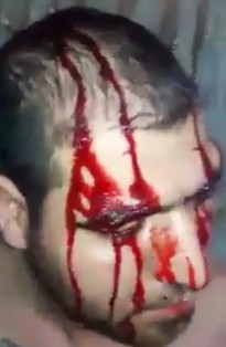 Fanatic Cuts his Head with Machete Blows