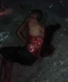 Thief Agonizing with Guts Exposed after being Stabbed by the Bictim