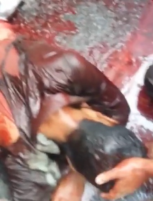 Young Man Ripped Apart by Truck