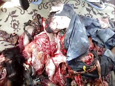 Worker Fell in Machine Sugar Cane Crusher