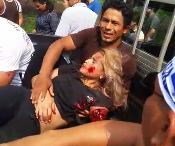 Woman's Arm Ripped Right Off