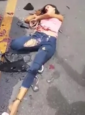 Pretty Girls Mutiliated in Horrific Accident