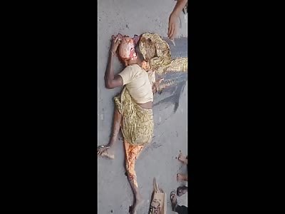 Horrific Aftermath Shows Womans Head Cracked Open and Coming Apart
