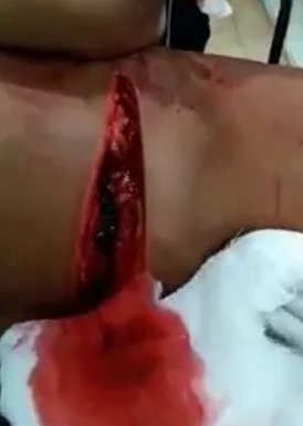 Brutal Machete Attack Victims