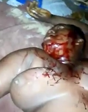 Large Woman with Big Tits Murdered Aftermath