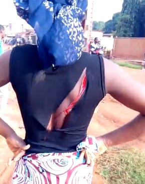 Woman Stabbed and Sliced During Fight