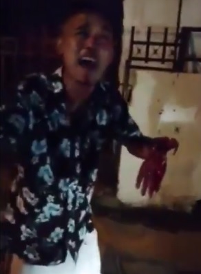 Man Loses His Hand During Machete Attack... Its Just Dangling 