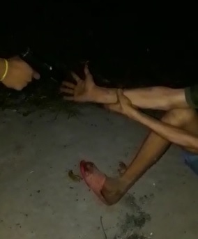 Thief Punished With Gunshot to Hand