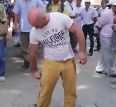 Moronic Protester Regrets Setting Himself on Fire