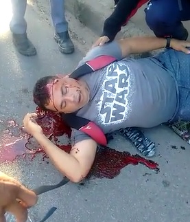 Guy Protected by the Force Still Alive After Being Shot in Head