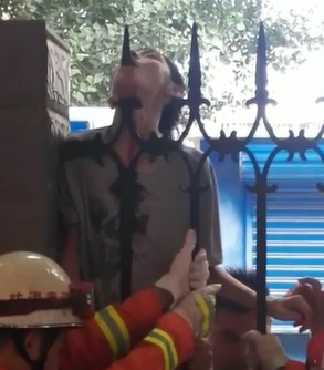 OUCH! Man Impaled Through Jaw