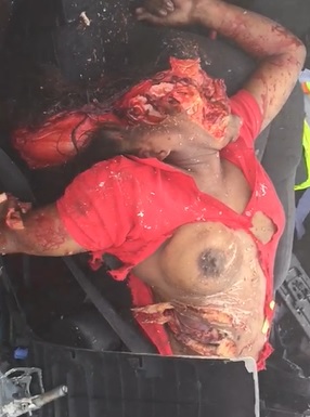 Horrific Aftermath... Womans Shirt Nearly Fully Disintegrated 