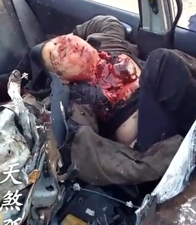 Gruesome Aftermath Woman Looks Peaceful 