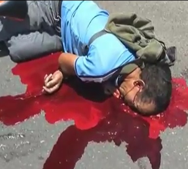 Dude Literally Drowns in His Own Blood