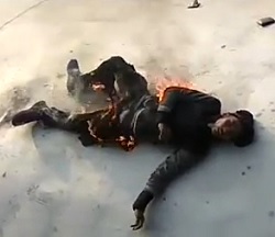 Failed Suicide by Electrocution Guy Still Alive in Total Agony