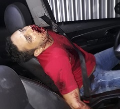 Homicide Scene..Dudes Mouth Blown the Fuck out