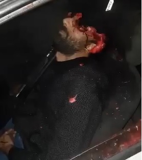 Shotgun Suicide Took his Whole Head Off