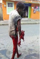 Thief Gets Sliced Up with Machete .. Walking in a Daze