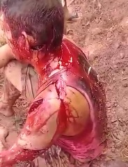 Gang Member Hacked up With Machete 