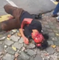 Damn! Dude Gruesomely Scalped From Accident