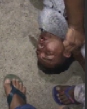 Dude LITERALLY Strangled With his Own Arm