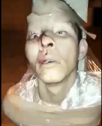 Tied with Plastic Wrap to a Pole and Beaten