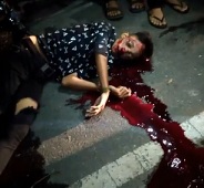 Accident with Dying Gasping Aftermath