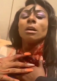 Transvestite Stabbed in the Neck Live Streams 