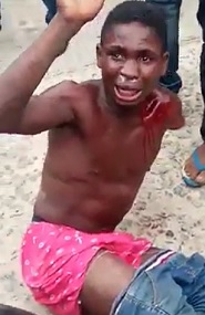 Beaten and Set on Fire