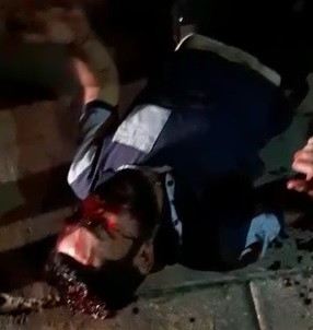 Bloody Crying Car Thief Begs for Mercy